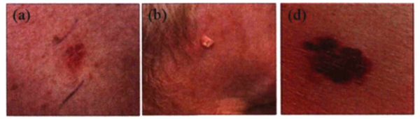 高光譜(pǔ)顯微成像技術在癌症診斷(duàn)中的應用